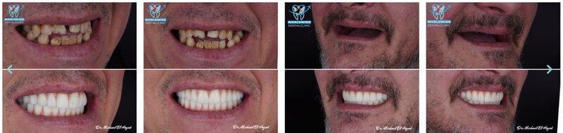 Worldwide Dental Clinic - Clinica stomatologica